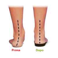 plantare-ortopedico.png